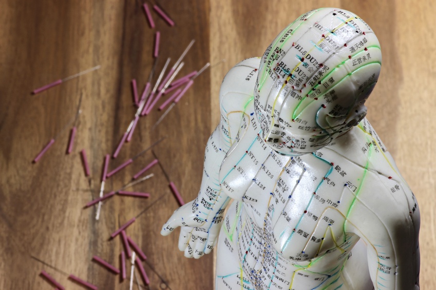 Traditionell chinesische Medizin Büste mit Nadeln - Traditionell chinesische Medizin